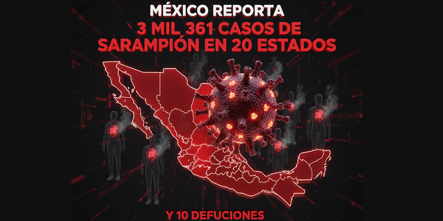 MÉXICO REPORTA 3 MIL 361 CASOS DE SARAMPIÓN EN 20 ESTADOS Y 10 DEFUNCIONES